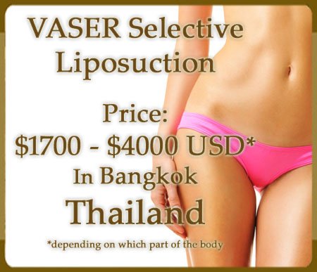 VASER Selective Liposuction Price in Thailand VASER Selective Liposuction Price in Thailand